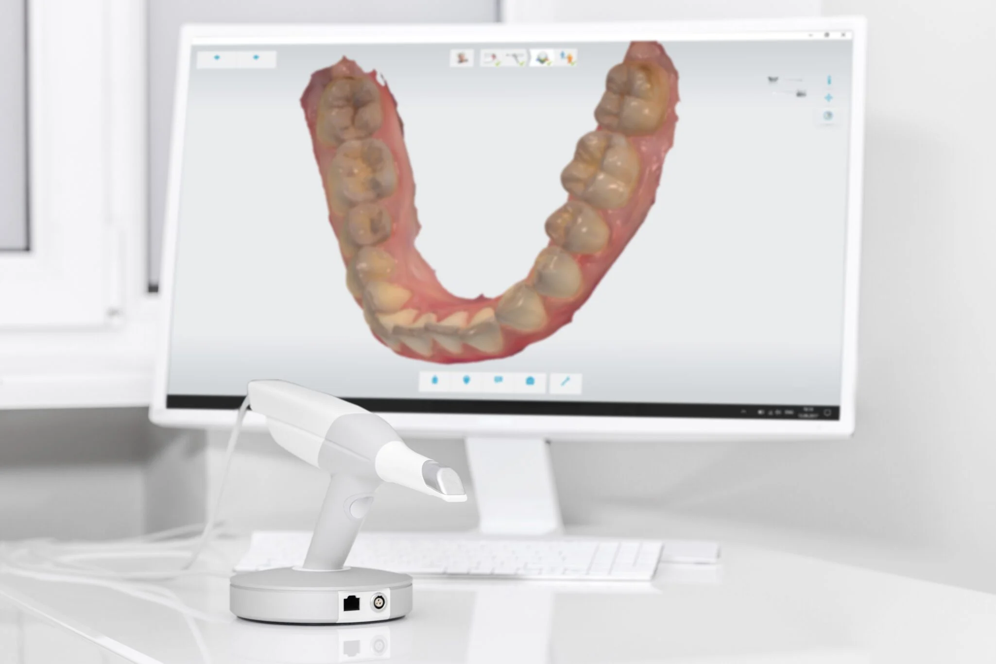 Trios 3D dental scanner and digital imaging equipment used at MDRN Dental Studio